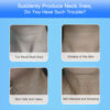 Neck Lifting Device