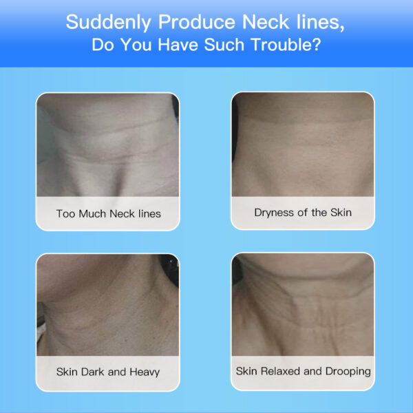 Neck Lifting Device