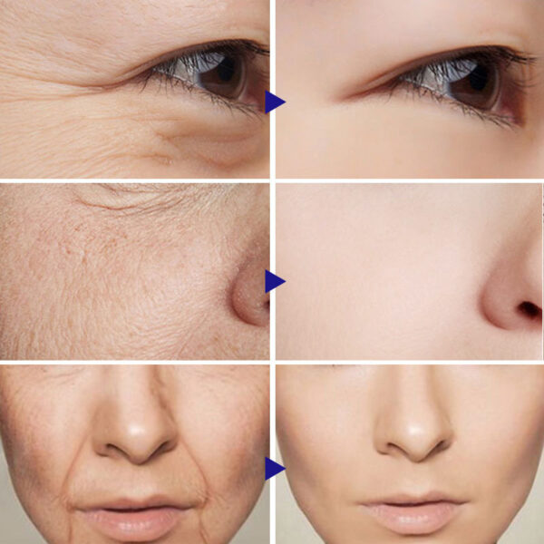 VOVA Vitamin C Serum Hyaluronic Acid - Image 5