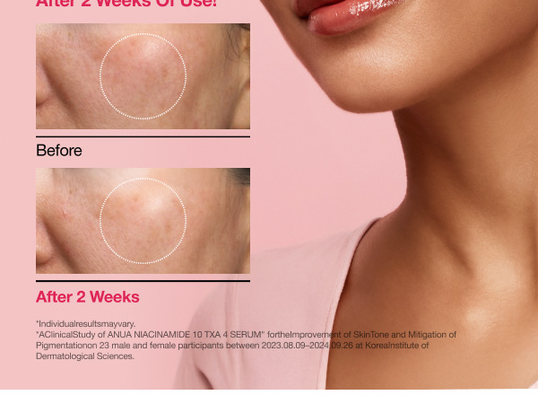 Anua Niacinamide TXA Serum 30ml - Image 5