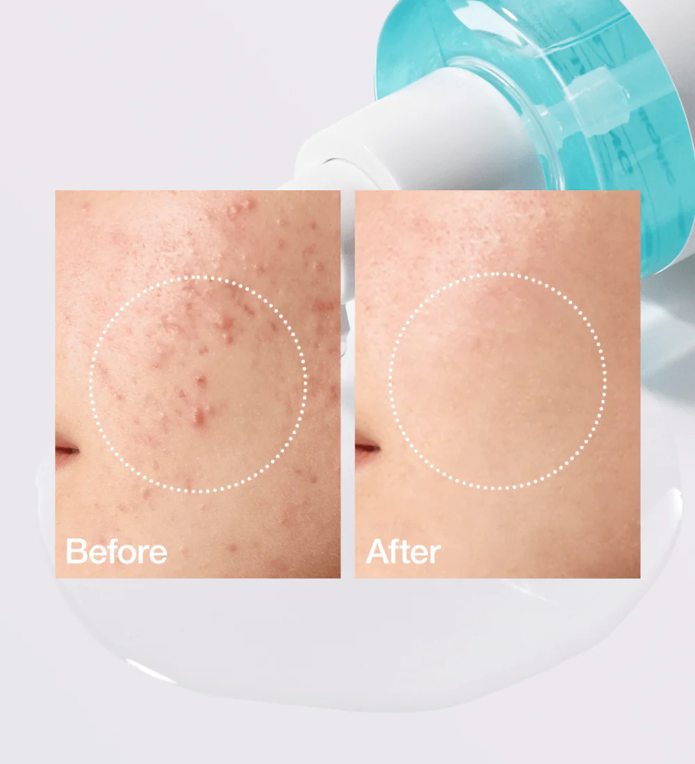 Anua BHA 2 Exfoliating Toner 150ml - Image 4