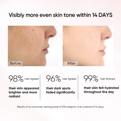 Anua - Peach 70% Niacinamide Serum - 30ml - Image 9